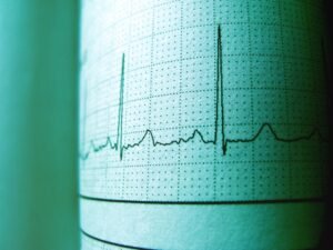 vertexpulse verification chamber identifiers ips